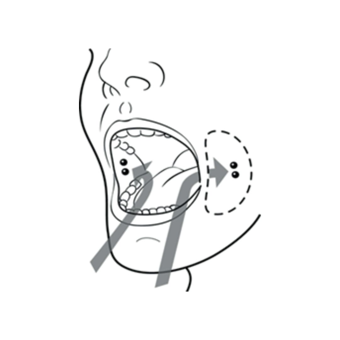 oral abortion pill insertion